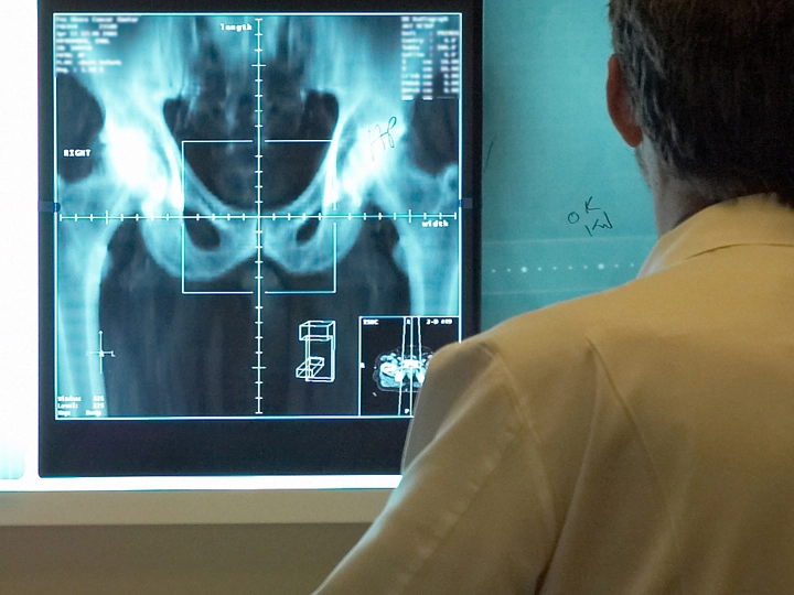 Doctor viewing X-ray scan
