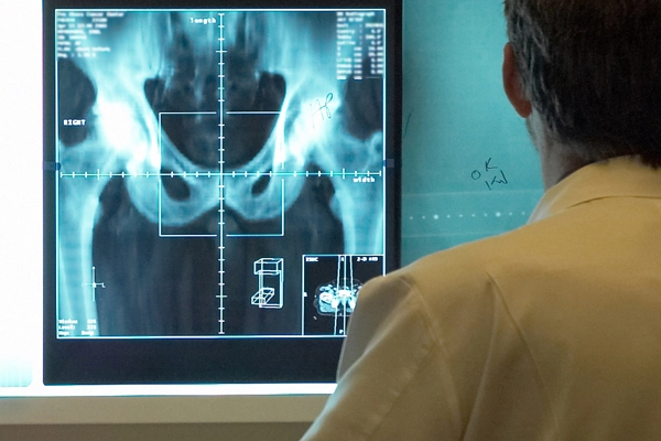 Doctor viewing X-ray scan