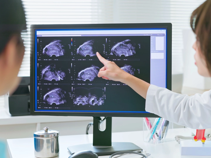 A doctor explains a woman's uterus ultrasound