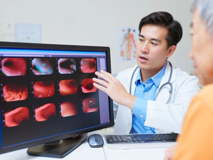 Doctor explain stomach cancer