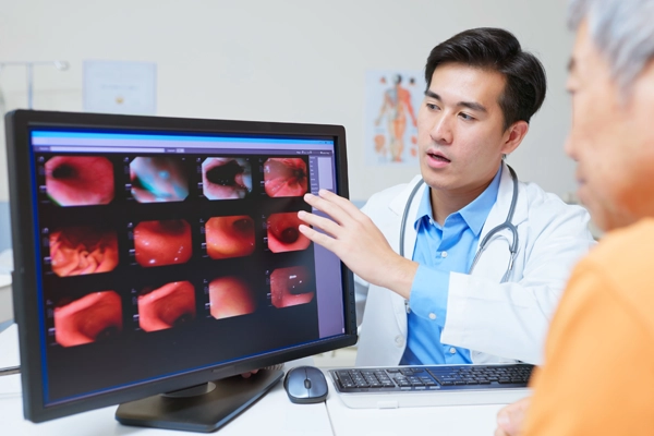 Doctor explain stomach cancer