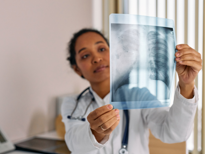 Doctor looking at x-ray