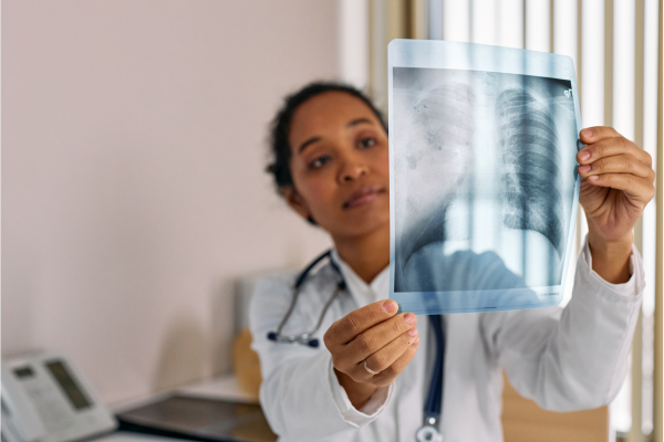 Doctor looking at x-ray